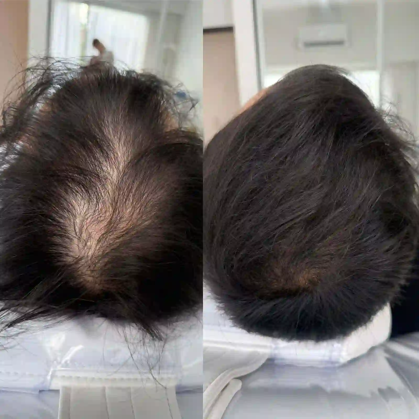 Antes y despues recuperación capilar Salta